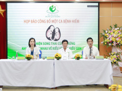 Bệnh viện Phụ sản Hà Nội công bố một ca hiếm phát hiện song thai cùng trứng