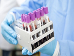 Có phải xét nghiệm máu sẽ phát hiện ung thư?
